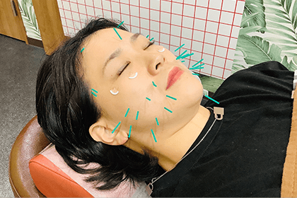 大阪市旭区の美容鍼で表情筋にアプローチする針施術アップ写真 美活ボディサロンめいてる