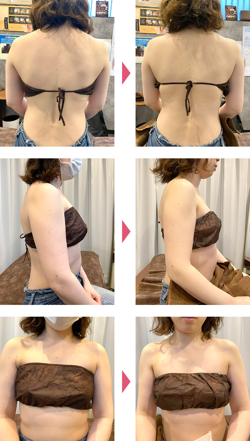 ブライダルビフォアアフター